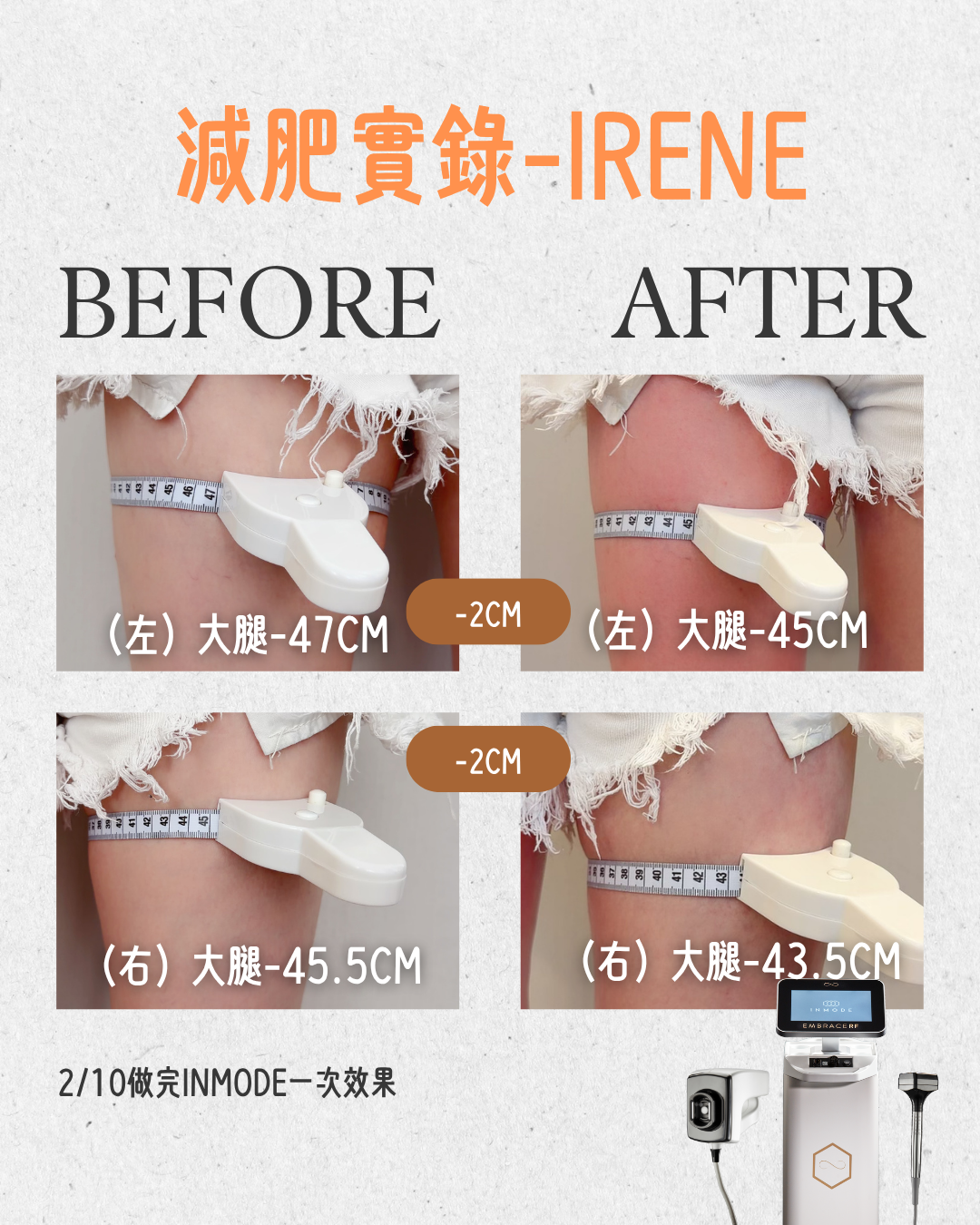 IRENE INMODE - 1